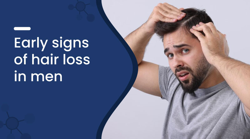 Early Signs of Hair Loss in Men