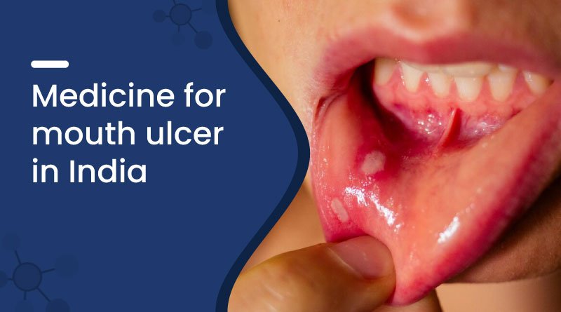 Medicine for Mouth Ulcer