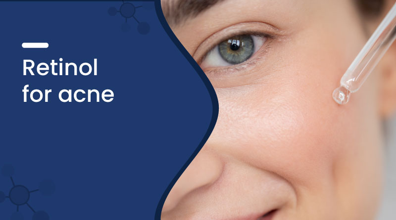 Retinol for Acne